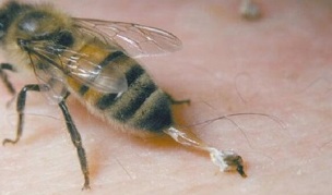 θεραπεία της αρθροπάθειας του ισχίου από τις μέλισσες